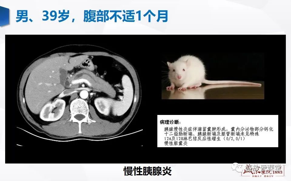 影像PPT - 【PPT】胰管增宽影像表现及意义-8
