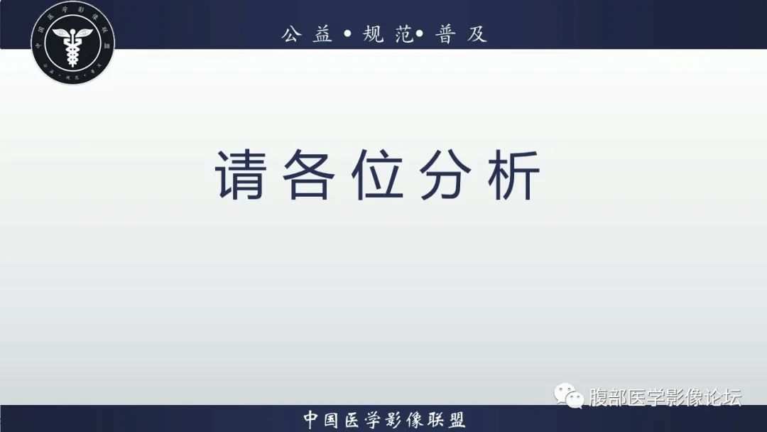 影像PPT - 【病例】腹膜后Castleman病1例CT影像诊断-16