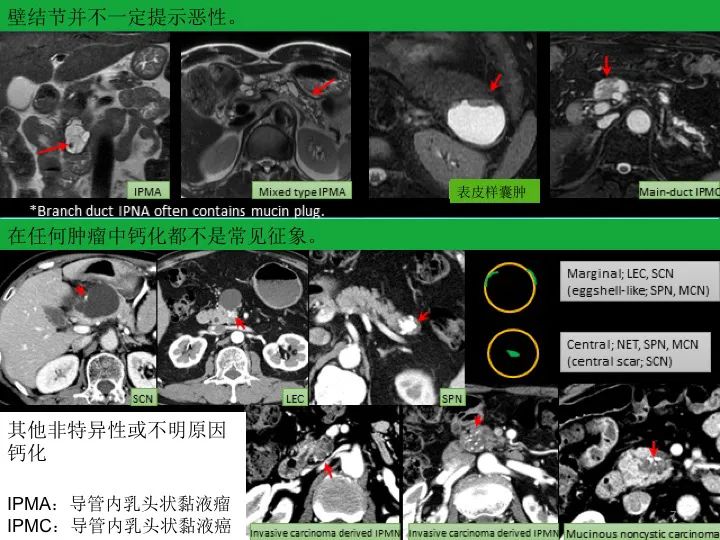 影像PPT - 【PPT】胰腺囊性病变影像学诊断要点与误区-7