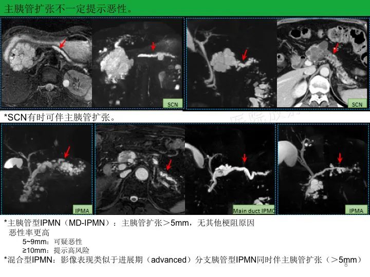 影像PPT - 【PPT】胰腺囊性病变影像学诊断要点与误区-8