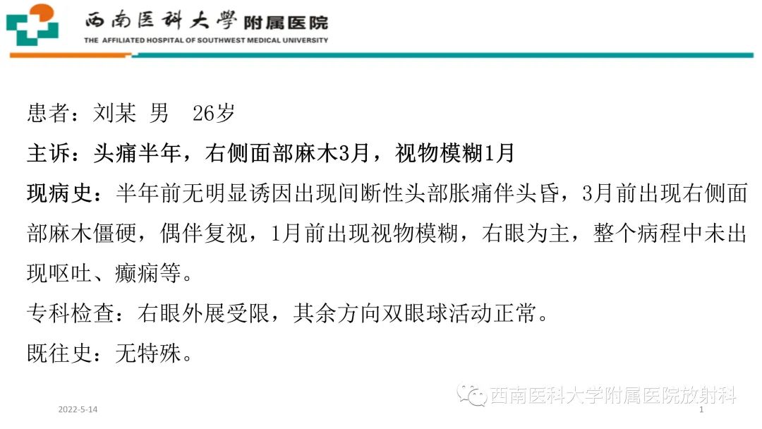 影像PPT - 【PPT】颅底脊索瘤-2