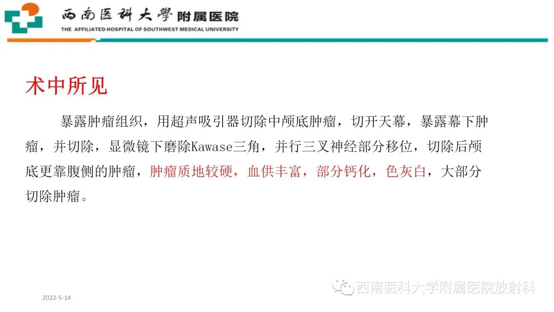 影像PPT - 【PPT】颅底脊索瘤-7