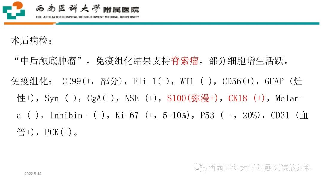 影像PPT - 【PPT】颅底脊索瘤-8