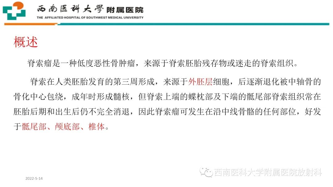 影像PPT - 【PPT】颅底脊索瘤-10