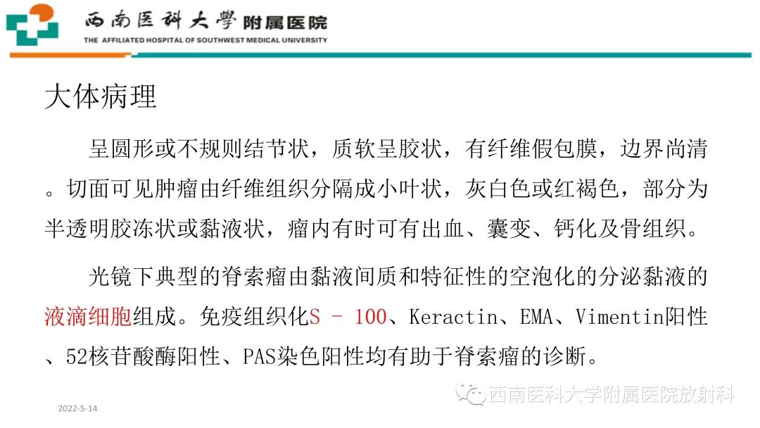 影像PPT - 【PPT】颅底脊索瘤-12