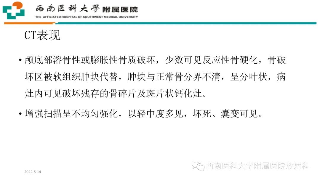 影像PPT - 【PPT】颅底脊索瘤-13