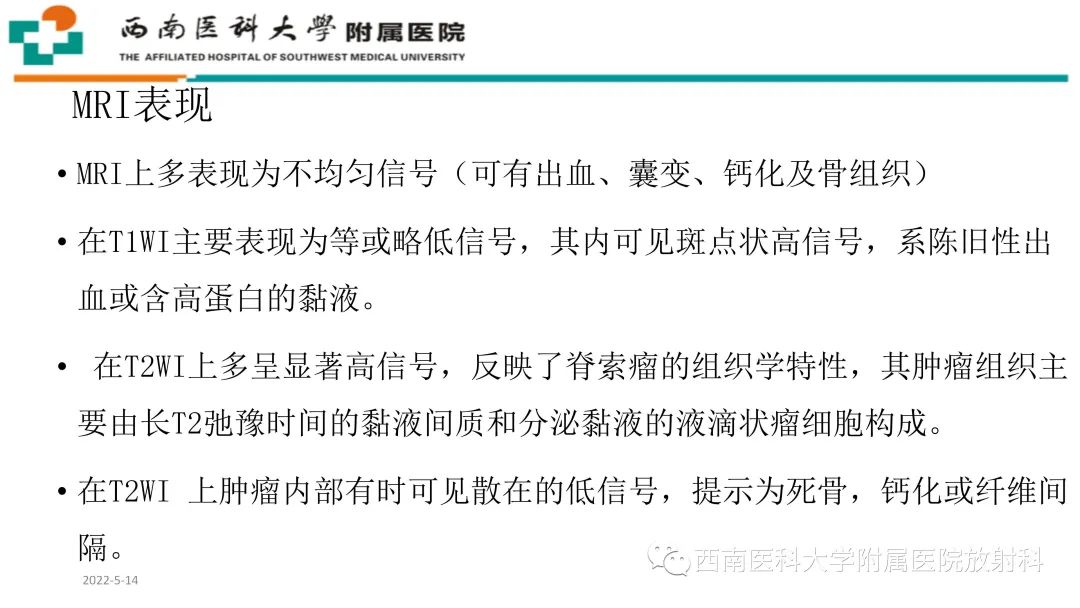 影像PPT - 【PPT】颅底脊索瘤-14