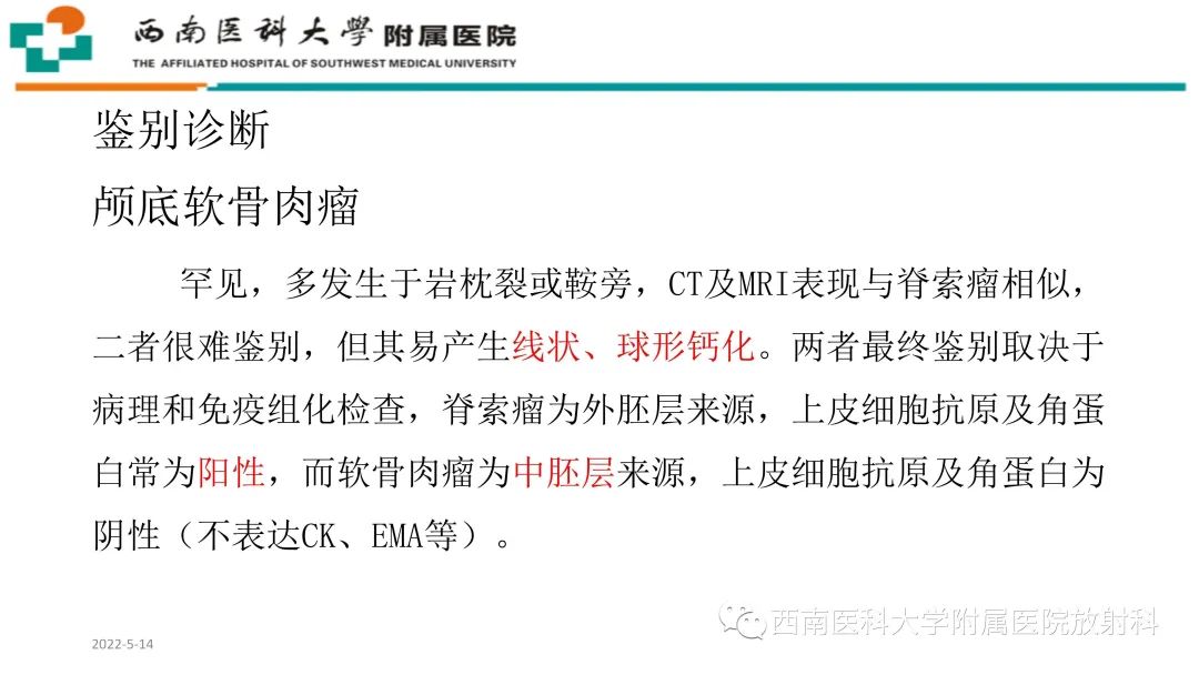 影像PPT - 【PPT】颅底脊索瘤-19