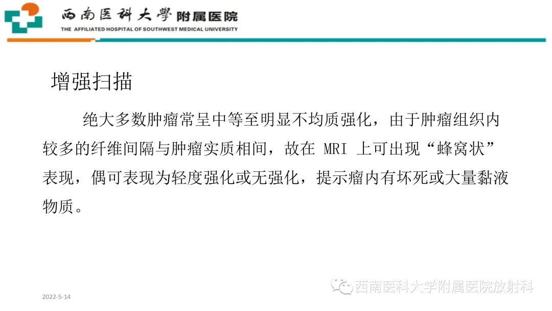 影像PPT - 【PPT】颅底脊索瘤-15
