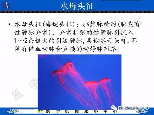 影像PPT - 水母头征-5