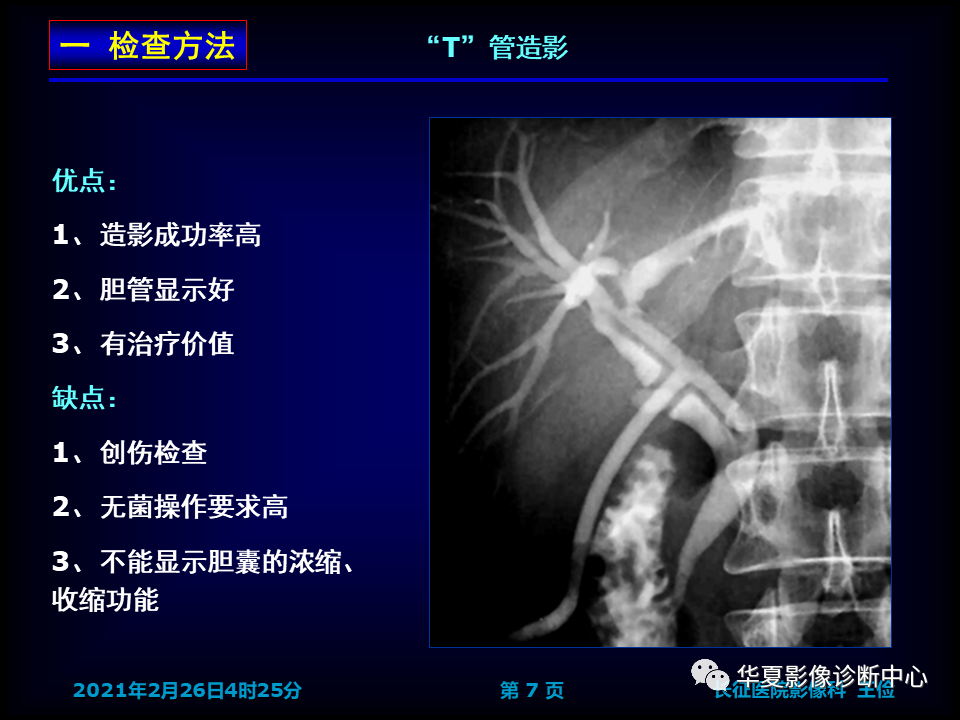 影像PPT - 【病例】坏死性胆囊炎1例MR影像-15