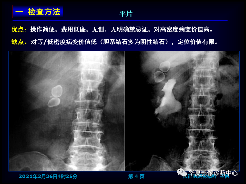 影像PPT - 【病例】坏死性胆囊炎1例MR影像-12