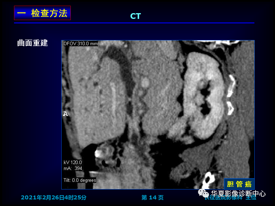 影像PPT - 【病例】坏死性胆囊炎1例MR影像-22