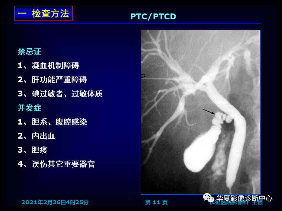 影像PPT - 【病例】坏死性胆囊炎1例MR影像-19