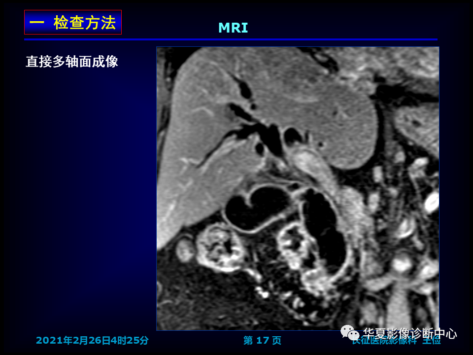 影像PPT - 【病例】坏死性胆囊炎1例MR影像-24