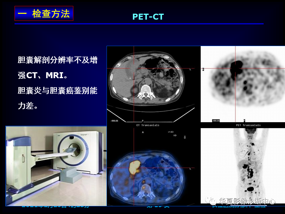 影像PPT - 【病例】坏死性胆囊炎1例MR影像-26