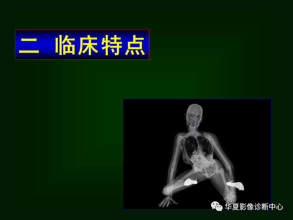影像PPT - 【病例】坏死性胆囊炎1例MR影像-28