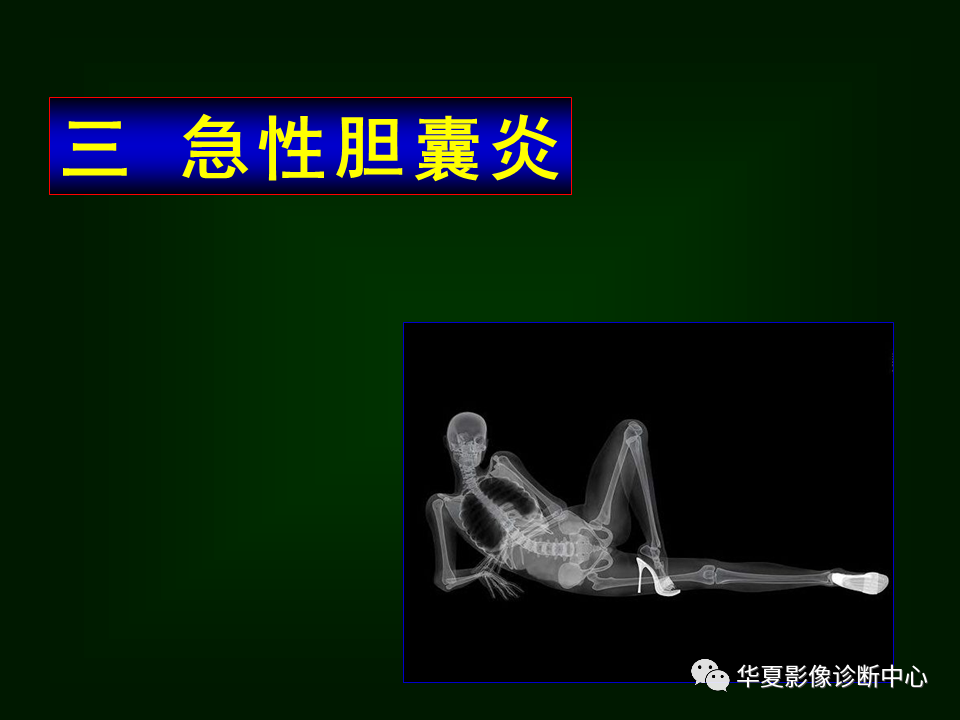 影像PPT - 【病例】坏死性胆囊炎1例MR影像-30