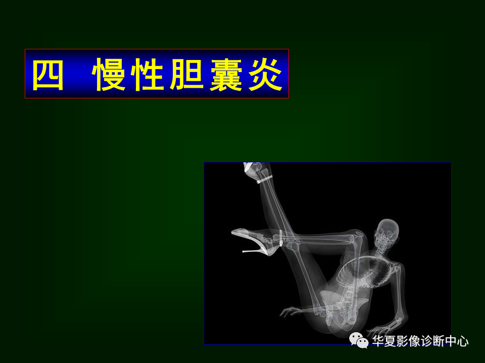 影像PPT - 【病例】坏死性胆囊炎1例MR影像-49