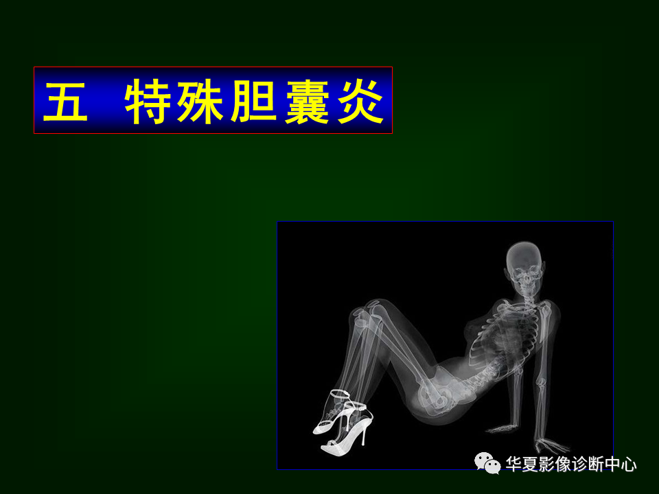 影像PPT - 【病例】坏死性胆囊炎1例MR影像-62