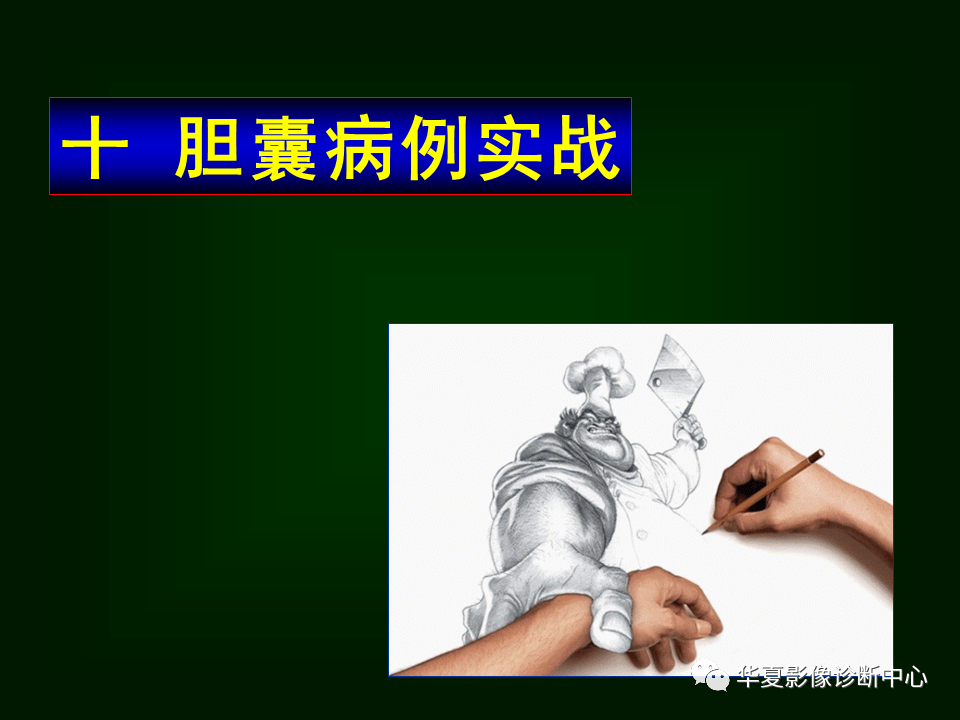 影像PPT - 【病例】坏死性胆囊炎1例MR影像-172
