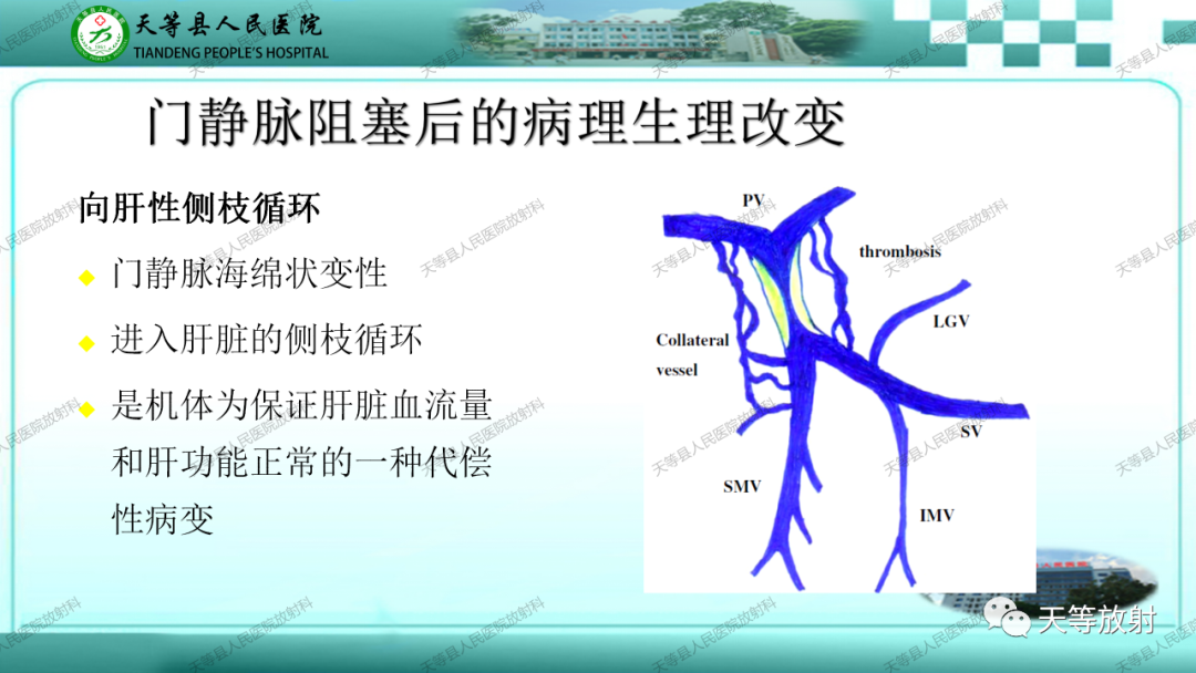 影像PPT - 【PPT】门静脉海绵样变性-6