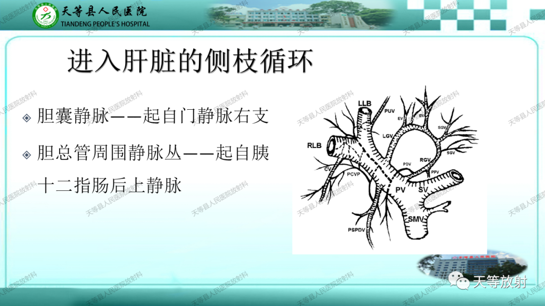 影像PPT - 【PPT】门静脉海绵样变性-8