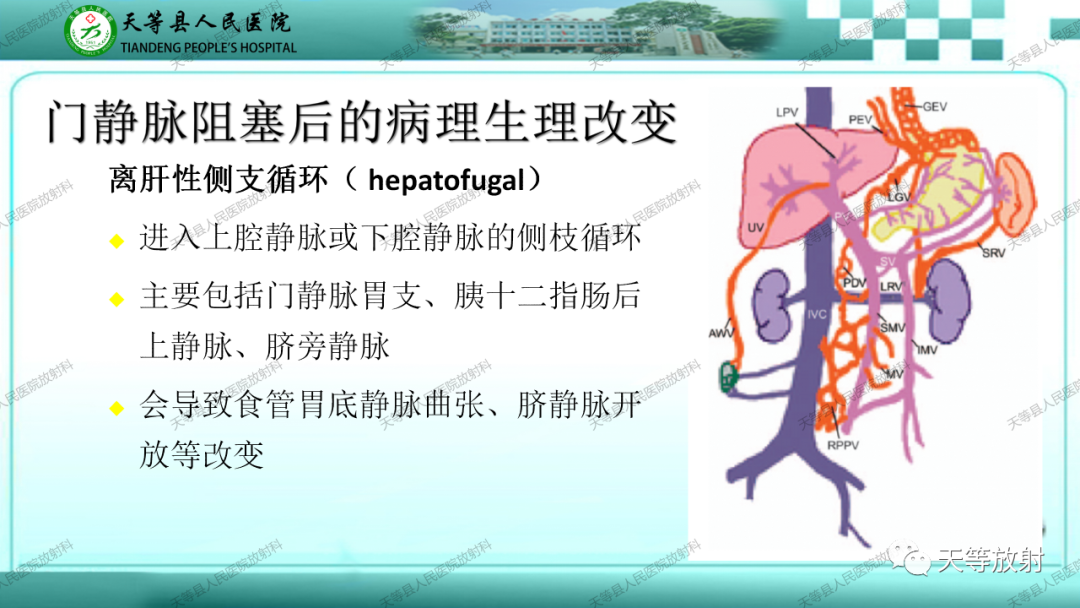 影像PPT - 【PPT】门静脉海绵样变性-5