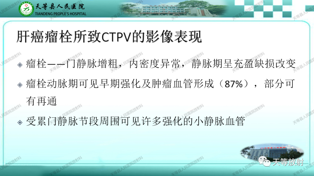 影像PPT - 【PPT】门静脉海绵样变性-26