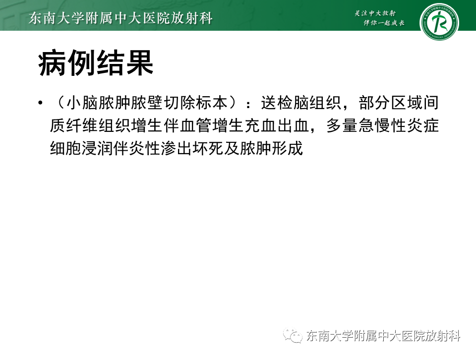 影像PPT - 【PPT】脑脓肿-5 影像PPT - 【PPT】脑脓肿-5