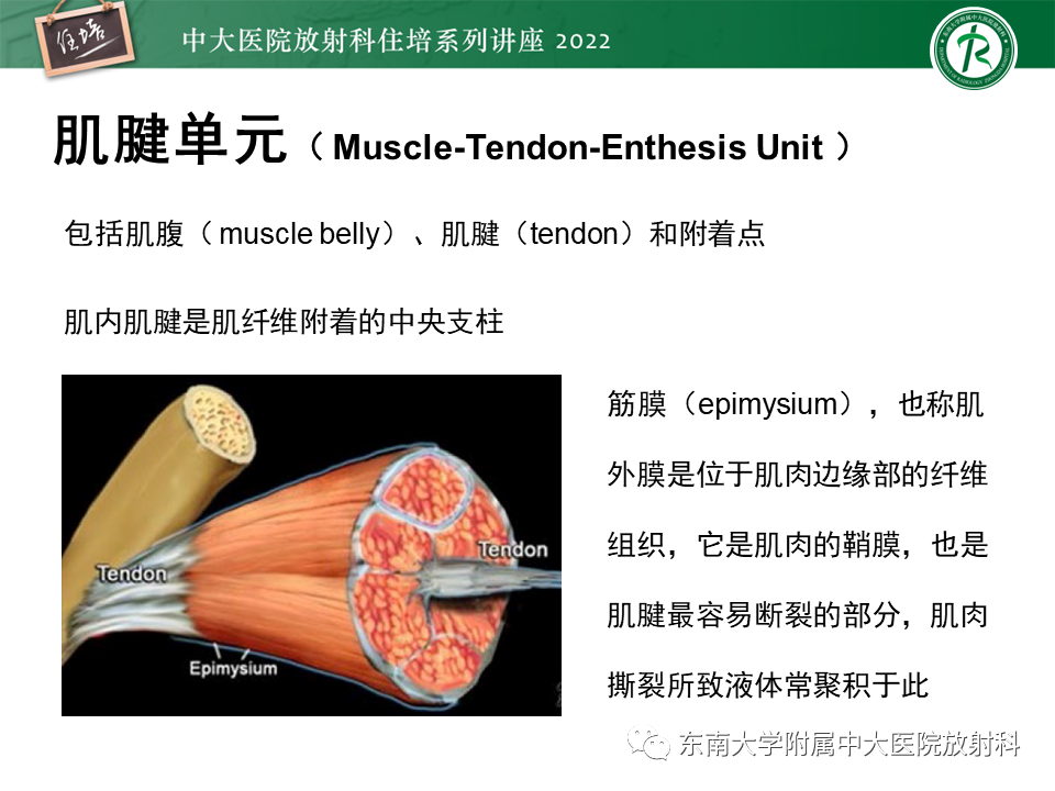 影像PPT - 【PPT】骨骼肌损伤的MR评估-2