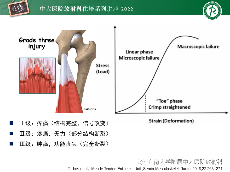 影像PPT - 【PPT】骨骼肌损伤的MR评估-5