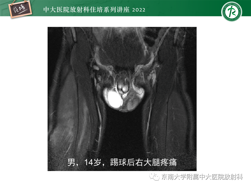 影像PPT - 【PPT】骨骼肌损伤的MR评估-24