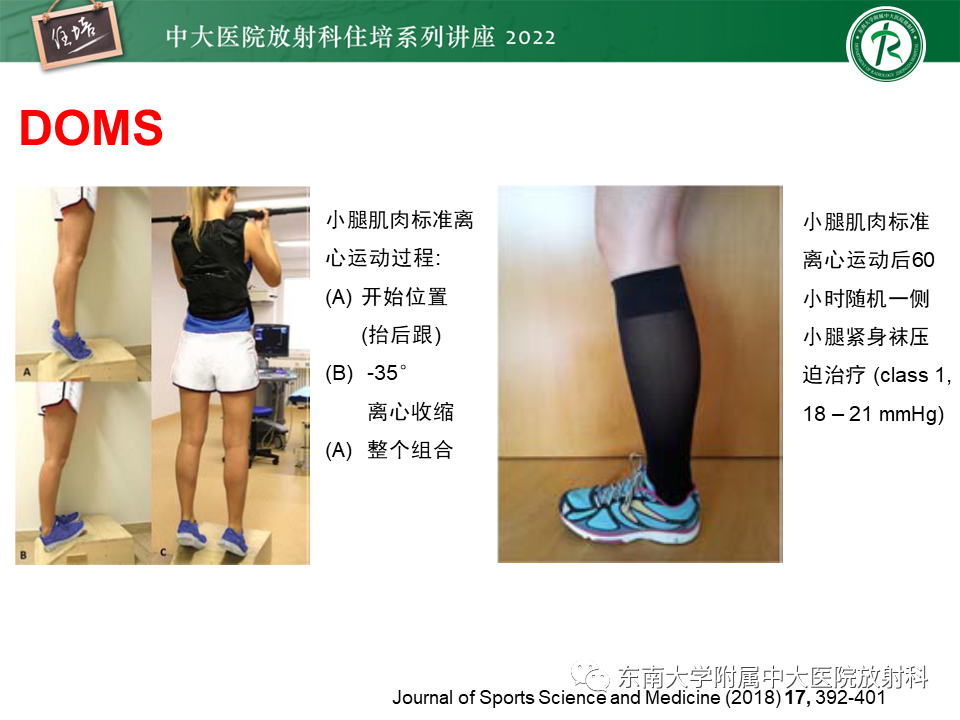 影像PPT - 【PPT】骨骼肌损伤的MR评估-25
