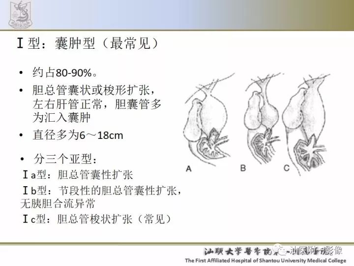 影像PPT - 【PPT】先天性胆总管囊肿影像学诊断-8