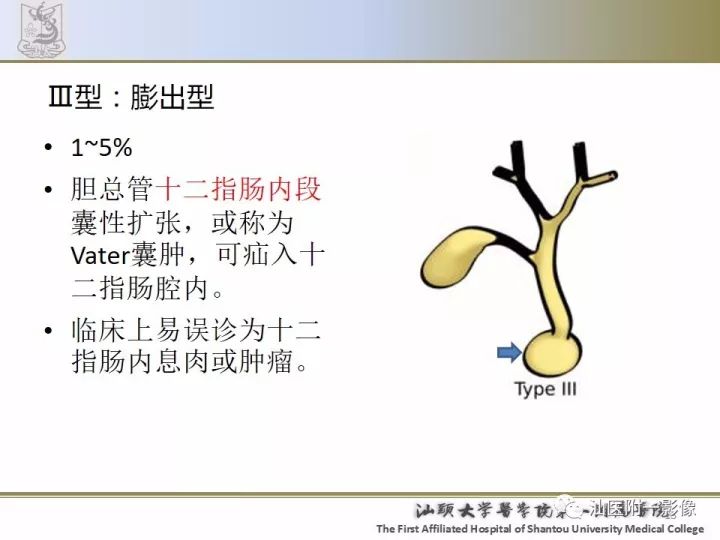 影像PPT - 【PPT】先天性胆总管囊肿影像学诊断-15