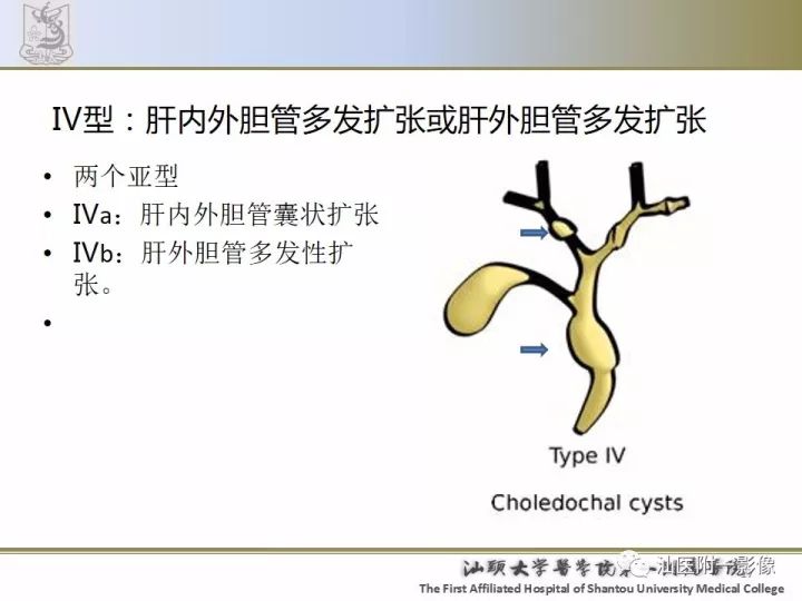 影像PPT - 【PPT】先天性胆总管囊肿影像学诊断-17