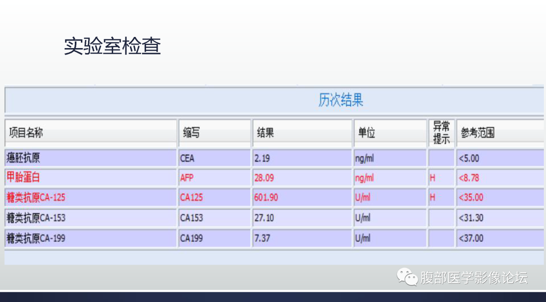 影像PPT - 【病例】肝脏胆管细胞癌1例MR影像-2