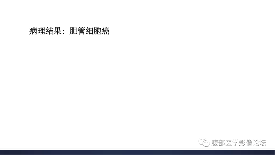 影像PPT - 【病例】肝脏胆管细胞癌1例MR影像-8