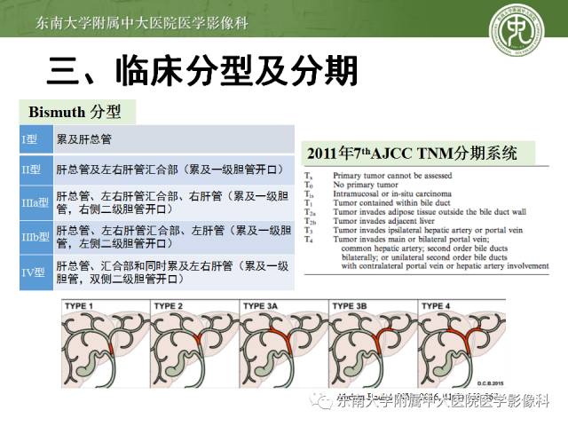 影像PPT - 【病例】肝脏胆管细胞癌1例MR影像-12