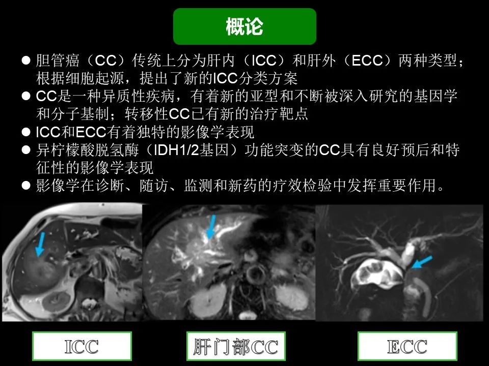 影像PPT - 【PPT】胆管癌（2019年）:最新的病理学、分类及影像学表现-3