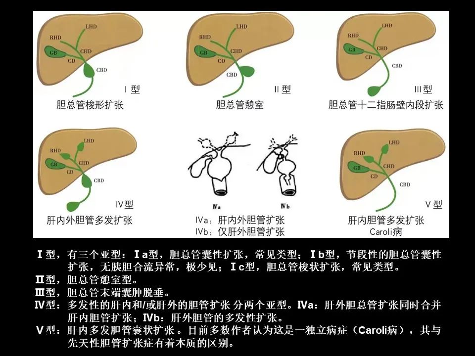 影像PPT - 【PPT】胆管癌（2019年）:最新的病理学、分类及影像学表现-11