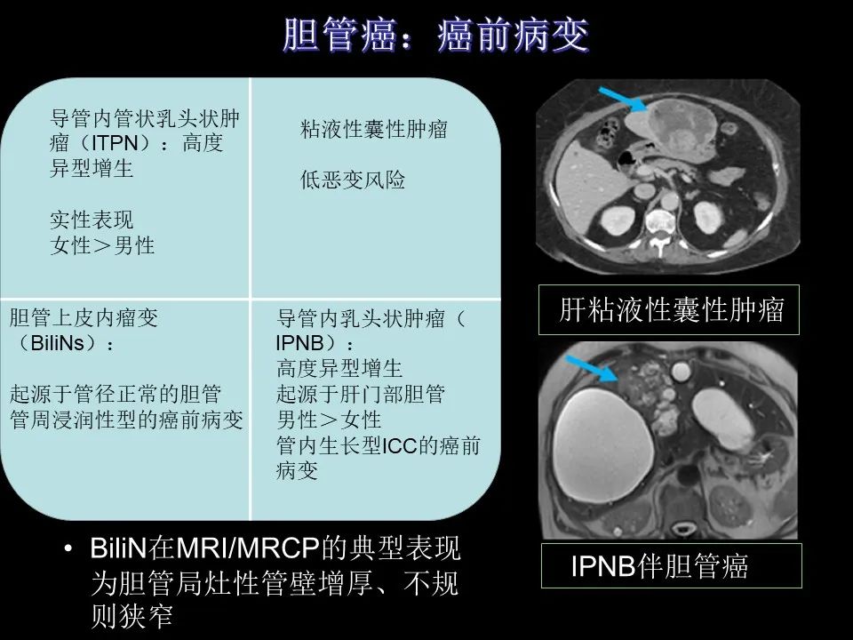 影像PPT - 【PPT】胆管癌（2019年）:最新的病理学、分类及影像学表现-12