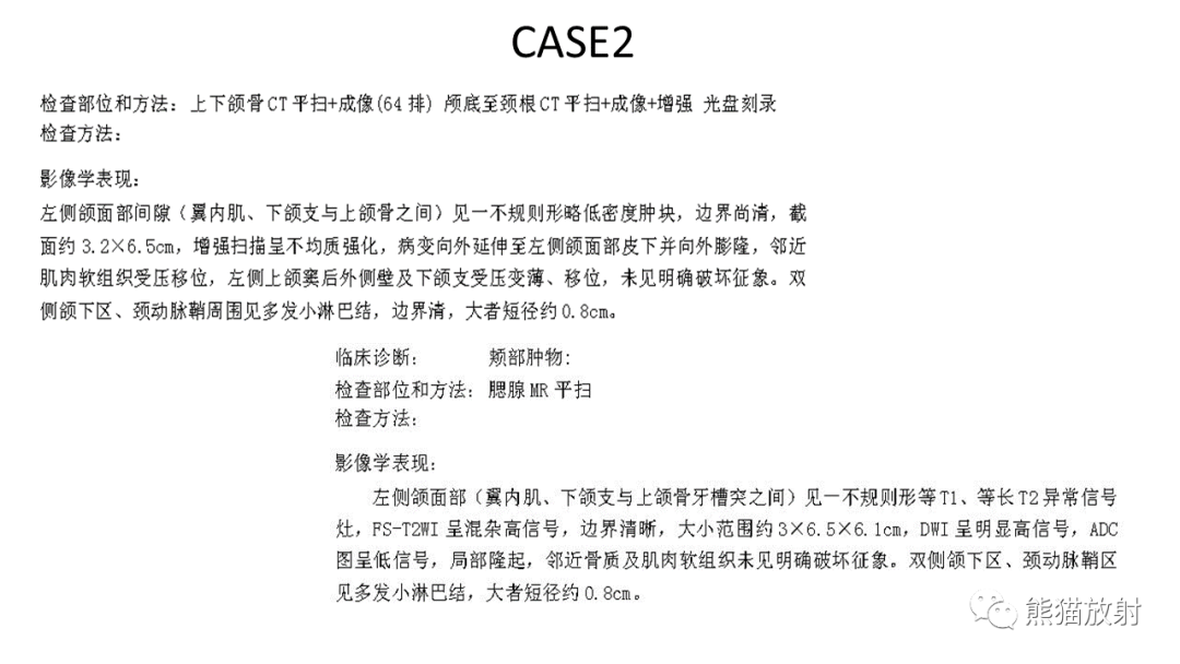 影像PPT - 【PPT】颞下窝滑膜肉瘤 VS 横纹肌肉瘤-27