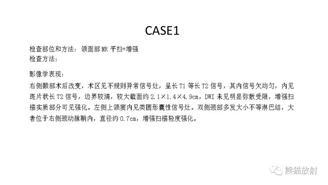 影像PPT - 【PPT】颞下窝滑膜肉瘤 VS 横纹肌肉瘤-26