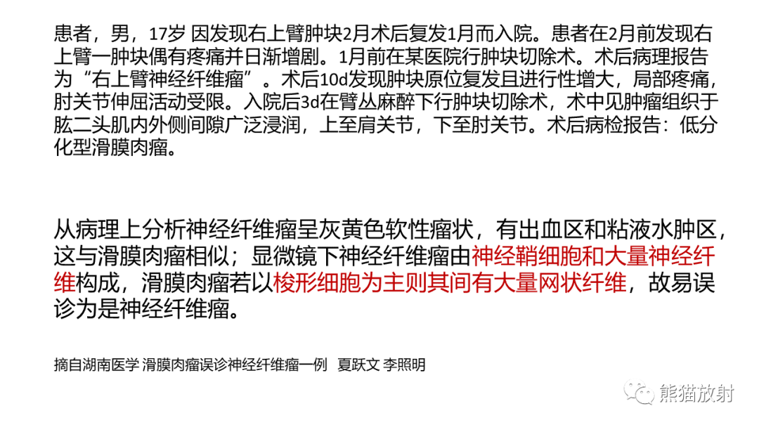 影像PPT - 【PPT】颞下窝滑膜肉瘤 VS 横纹肌肉瘤-30