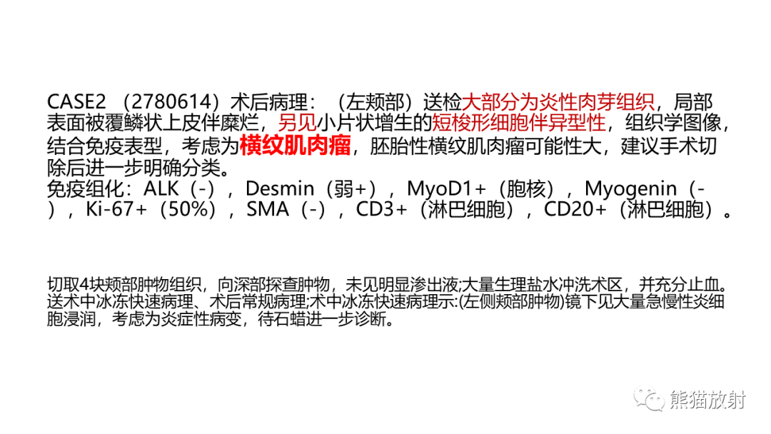 影像PPT - 【PPT】颞下窝滑膜肉瘤 VS 横纹肌肉瘤-29