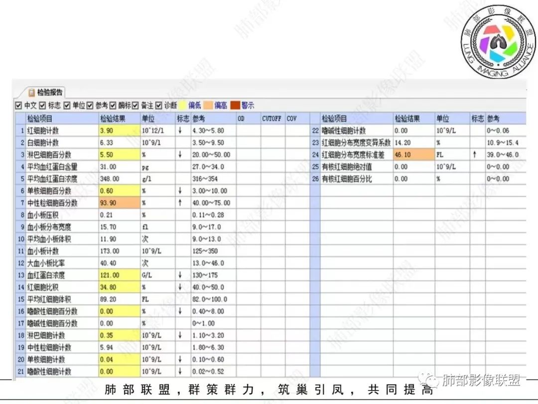 影像PPT - 【病例】 最经典的肺炎型肺癌1例CT-3 影像PPT - 【病例】 最经典的肺炎型肺癌1例CT-3