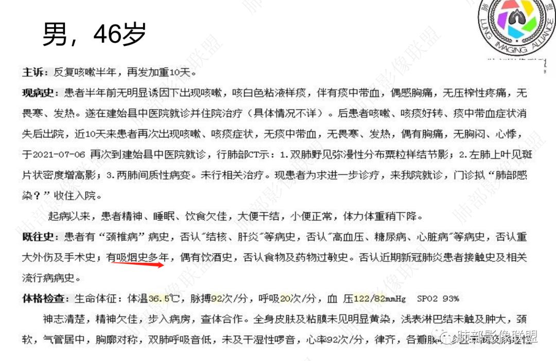 影像PPT - 【病例】 最经典的肺炎型肺癌1例CT-48 影像PPT - 【病例】 最经典的肺炎型肺癌1例CT-48