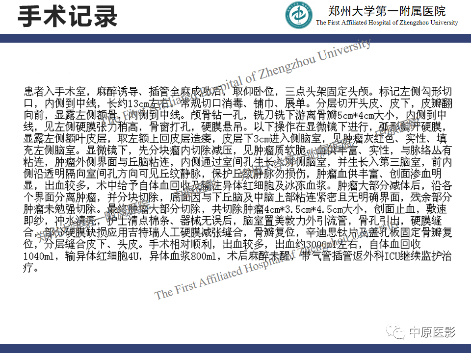 影像PPT - 【病例】中枢神经细胞瘤1例MR-10